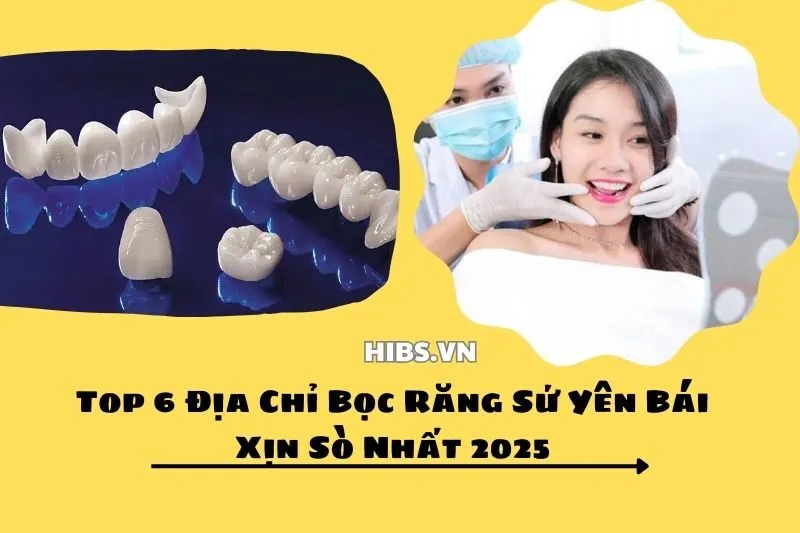 Top 6 Địa Chỉ Bọc Răng Sứ Yên Bái Xịn Sò Nhất 2025